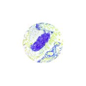Pneumocystis Stain Kit